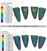 強(qiáng)度分析